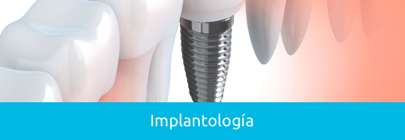 implantologia